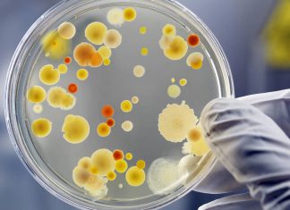 Peligroso hongo es detectado en El Salvador