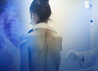 Nicaragua pionera en cirugías gratuitas de escoliosis