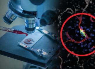 Descubren anticuerpo que frena la metástasis Descubren anticuerpo que frena la metástasis