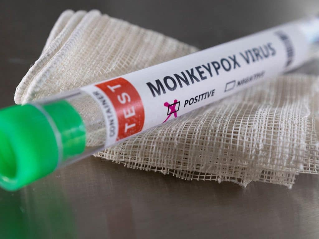 La notoriedad de los síntomas de la Viruela del Mono, permite aislar rápidamente los casos sospechosos.