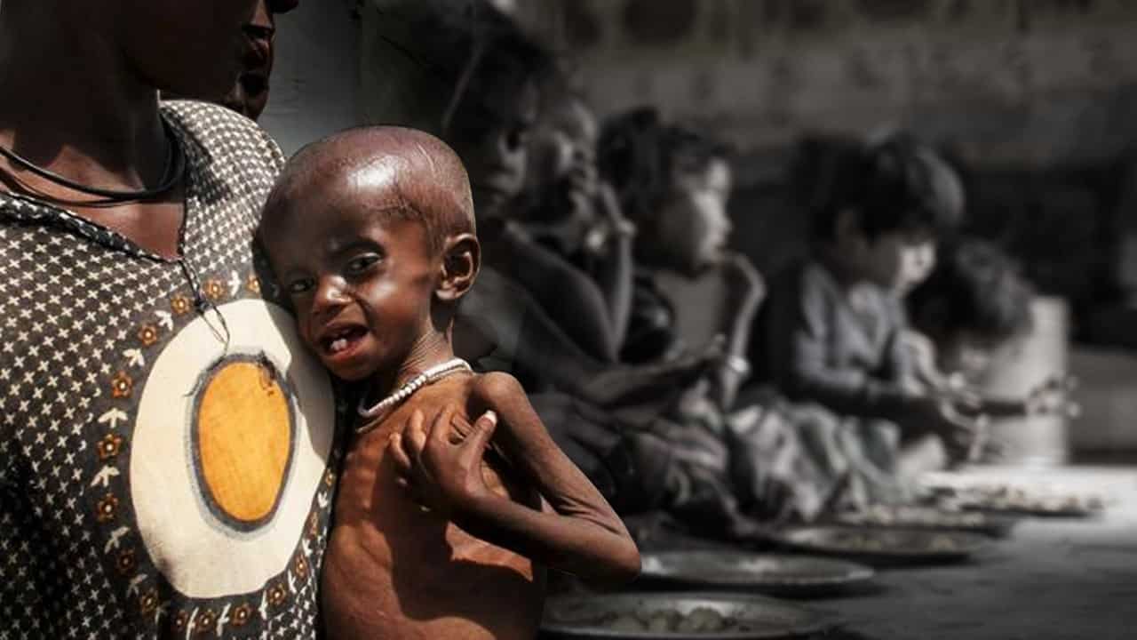 Onu Más De 45 Millones De Niños En El Mundo Padecen Hambre Y Malnutrición 3515