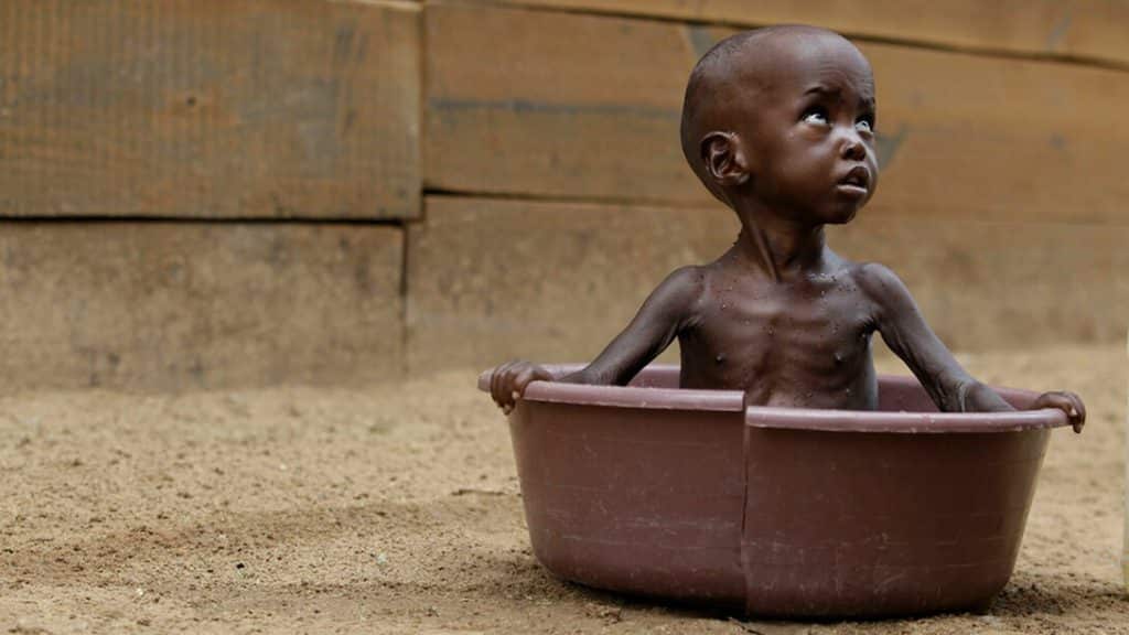 La malnutrición, ha aumentado hasta 12 veces el riesgo de mortalidad infantil. Foto: Meer
