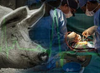 Trasplantan con éxito dos corazones de cerdos a humanos