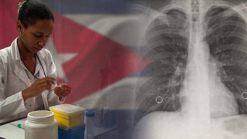A pesar del bloqueo económico, la vacuna cubana contra el cáncer de pulmón, es desarrollada con acuerdos de empresa estadounidense. Foto: JP+