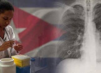 Vacuna cubana contra el cáncer de pulmón se desarrolla en alianza con EEUU