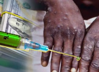 Vacuna contra la viruela del mono es aprobada por la Unión Europea