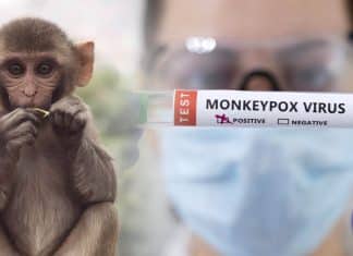 China comienza el desarrollo de vacuna contra la viruela del mono