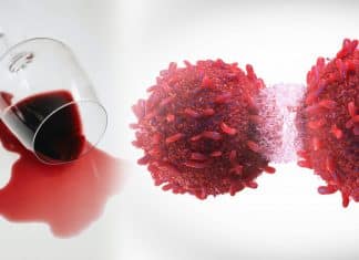 5 types of cancer related to the alcohol consumption