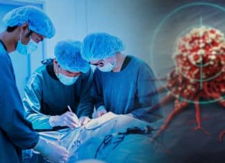 Paciente sobrevive a 12 tumores en España, y crea esperanzas para la cura del cáncer