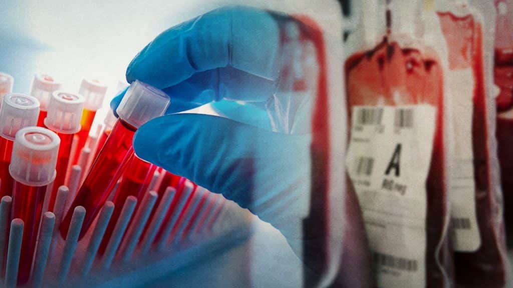 Es la primera vez que se cultivan glóbulos rojos en un laboratorio para realizar transfusión a una persona.