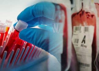 Pacientes reciben sangre artificial como prueba de un ensayo clínico