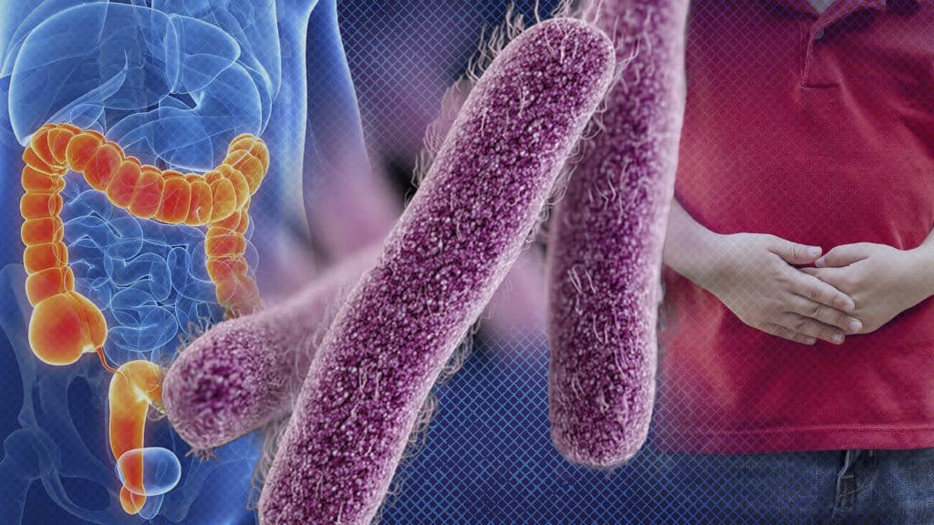 CDC warns about Shigella bacteria