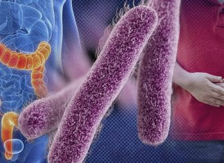 CDC warns about Shigella bacteria CDC warns about Shigella bacteria