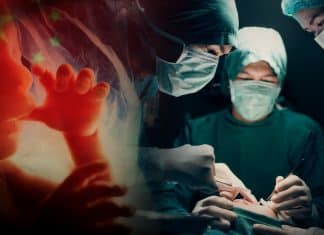 El insólito caso del ‘feto gemelo’ en el cerebro de una niña en China