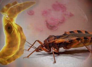 What is the Chagas Disease and why to raise awareness about it? What is the Chagas Disease and why to raise awareness about it?