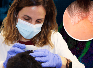 Cases of ringworm infection reported in New York City Cases of ringworm infection reported in New York City