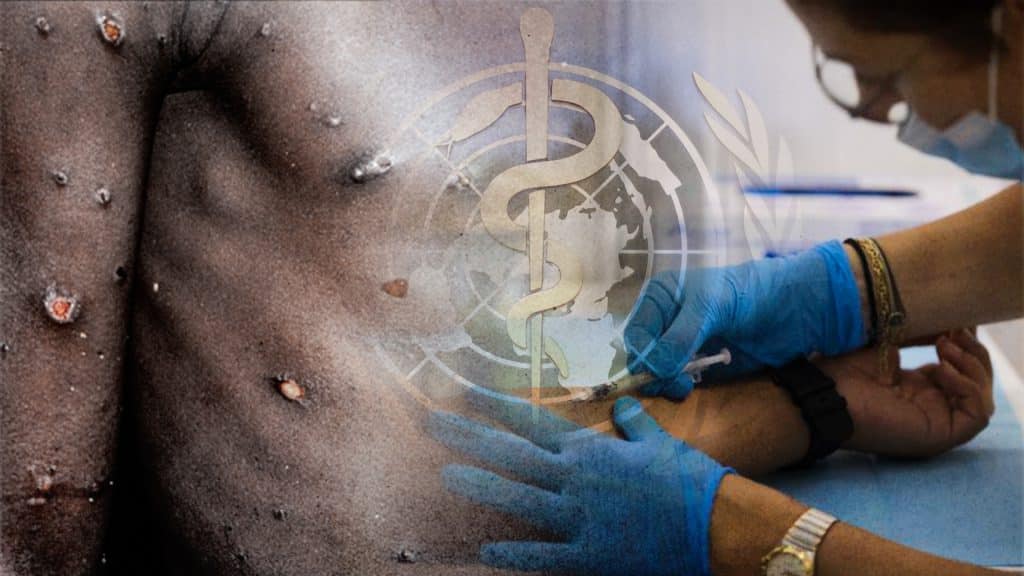 Monkeypox is no longer a global health emergency