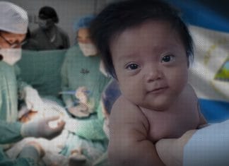 The free maternal and fetal surgeries are progressing in Nicaragua Nicaragua develops free maternal-fetal surgeries in the country.