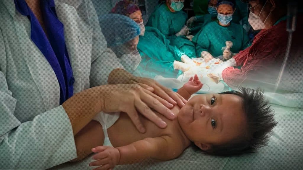 Las cirugías fetales han sido un éxito en el sistema de salud gratuito de Nicaragua.