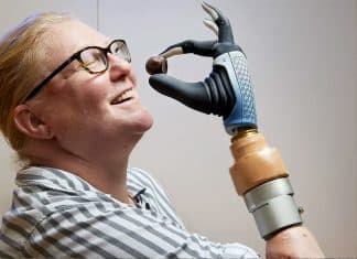 Mia Hand, la prótesis que se conecta a huesos, músculos y nervios del ser humano a través de IA