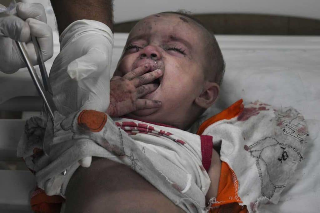 Un bebé palestino herido en un ataque israelí recibe atención médica en un hospital en Deir al Balah, situado en el sur de la Franja de Gaza. (AP)