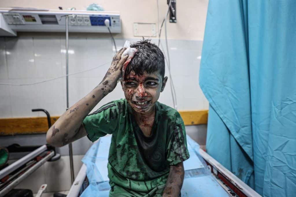 Un niño herido aguarda atención médica en el Hospital Nasser de Jan Yunis después de un ataque aéreo israelí. (Mustafa Hassona)