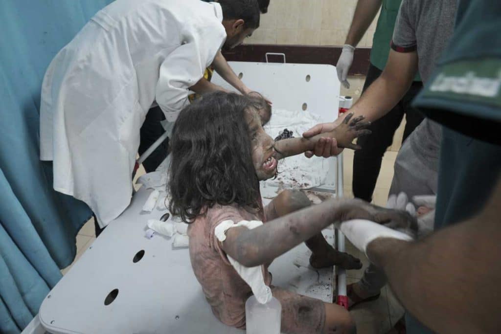Un menor palestino herido en el ataque aéreo israelí recibe cuidados médicos en un hospital ubicado en Deir al Balah, en el sur de la Franja de Gaza. (AP)