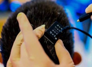 Neuroprótesis, el avance médico contra los efectos de la enfermedad de Parkinson