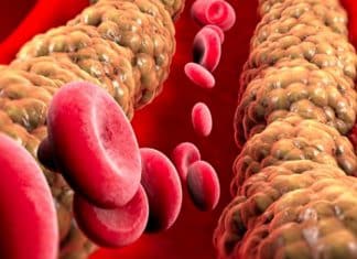 Medicamentos para reducir el colesterol también matan células vasculares envejecidas