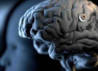 Implantan chip cerebral a un humano