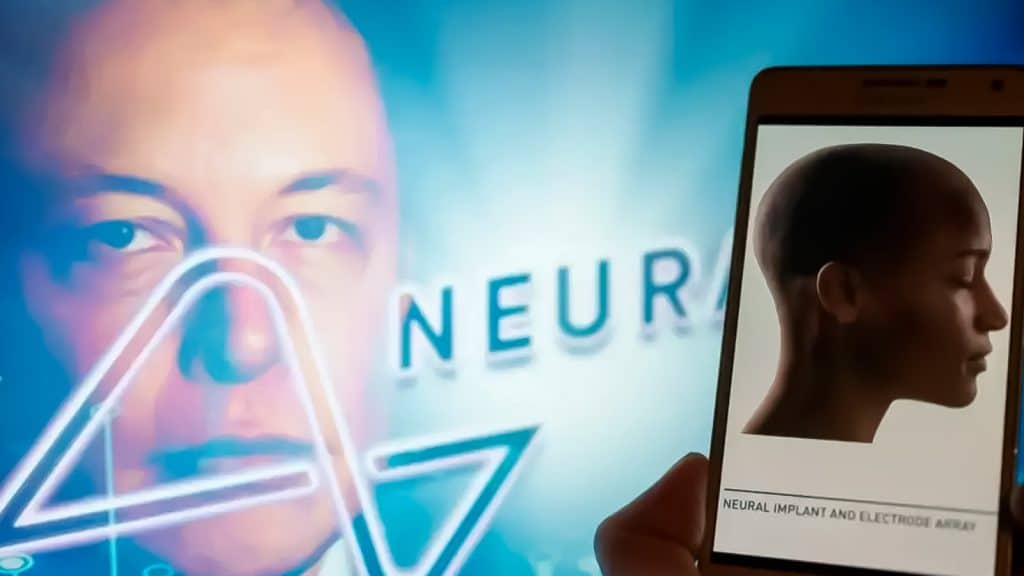 Neuralink revela detalles sobre el avance del paciente a quien le fue implantado un chip cerebral, en enero 2024