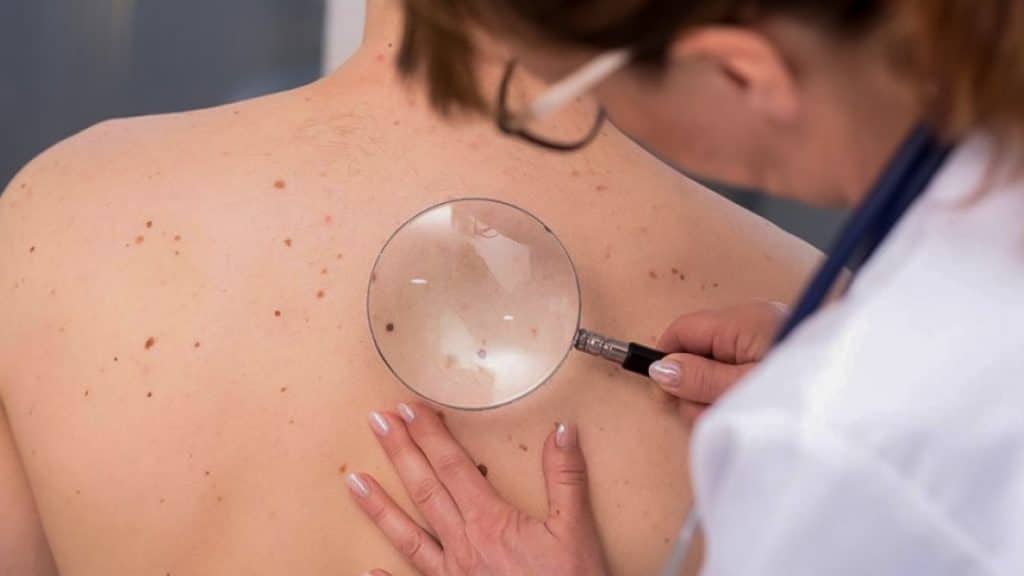 La vacuna contra el cáncer de piel, también se está probando para tratar otro tipo de cánceres. 