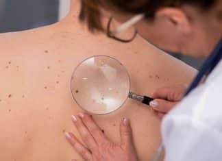 Científicos desarrollan la primera vacuna contra el cáncer de piel La vacuna contra el cáncer de piel, también se está probando para tratar otro tipo de cánceres.