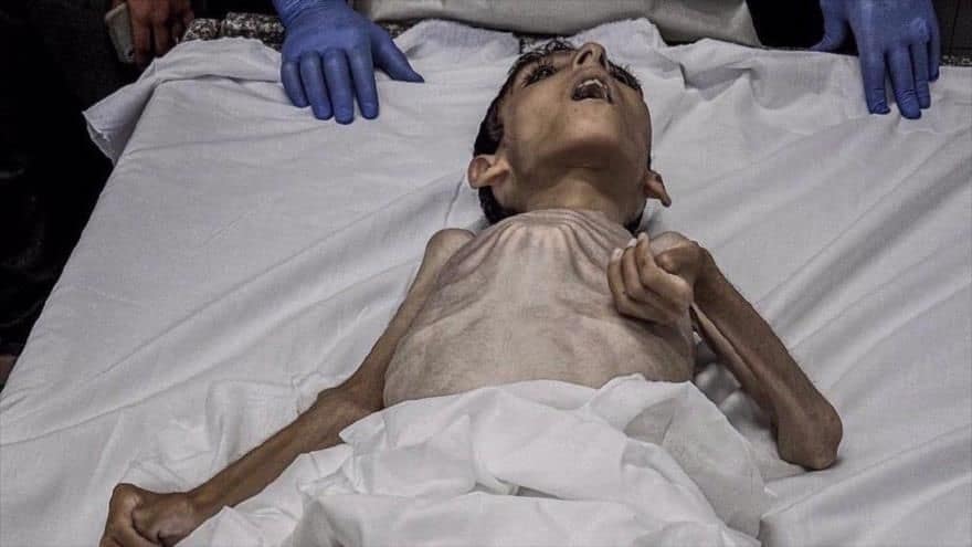 Bloqueo impuesto por Israel contra Gaza, provoca la muerte por desnutrición de niños palestinos.