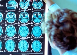 ¿Qué sucede en el cerebro cuando estamos muriendo?