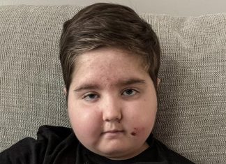 Excluyen de un nuevo tratamiento a un niño de 11 años con un tumor El ONC201, demostró efectividad en pacientes en condición similar a la de Ronnie Hood, el niño excluido de pruebas experimentales.