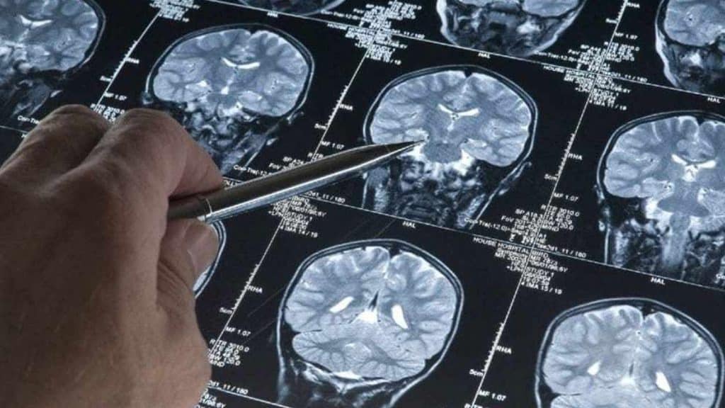 Se prevé que 2025 inicien los ensayos clínicos del dispositivo para el tratamiento del Alzheimer.