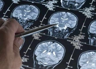 Rusia crea dispositivo para el tratamiento del Alzheimer Se prevé que 2025 inicien los ensayos clínicos del dispositivo para el tratamiento del Alzheimer.