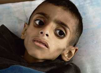 Bombardeo y desnutrición, el doble castigo para los niños de Gaza Gaza asegura que también EEUU, Francia, Alemania y Reino Unido tienen que responder por esta catástrofe humanitaria