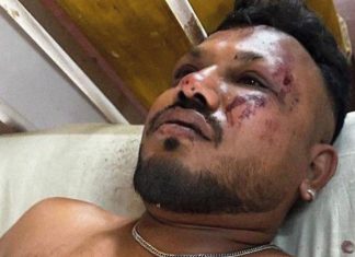 Encuentran a un sobreviviente del accidente aéreo Boeing 787-8 en la India Bajo los escombros encontraron a un sobreviviente del accidente de vuelo AI 171 - Boeing Dreamliner 787 en la India.