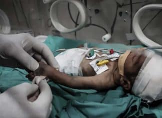 Bebés de Gaza al borde de la hambruna por bloqueo israelí Hamás y la ONU alertan de catástrofe humanitaria infantil en Gaza