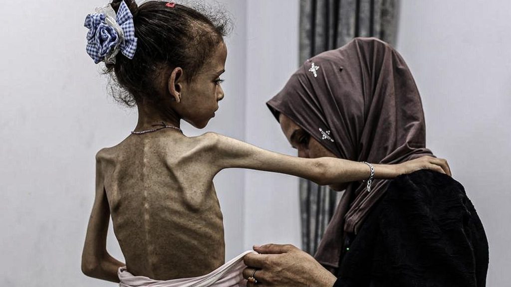 Más de un tercio de los gazatíes pasan días sin acceso a alimentos