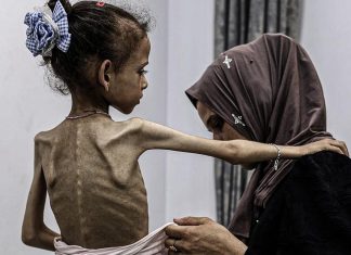 China exige a Israel el cese inmediato de la agresión en Gaza Más de un tercio de los gazatíes pasan días sin acceso a alimentos