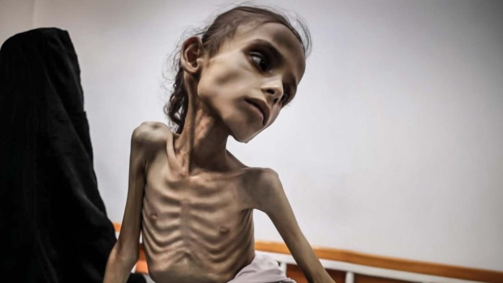 Lazzarini: “Muchos niños no sobrevivirán al hambre en Gaza”