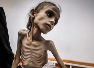ONU: Un tercio de los niños en Gaza sufre desnutrición severa y no sobrevivirá Lazzarini: “Muchos niños no sobrevivirán al hambre en Gaza”