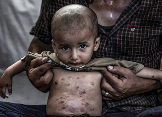 Más de 500.000 niños en Gaza expuestos a epidemias por colapso sanitario