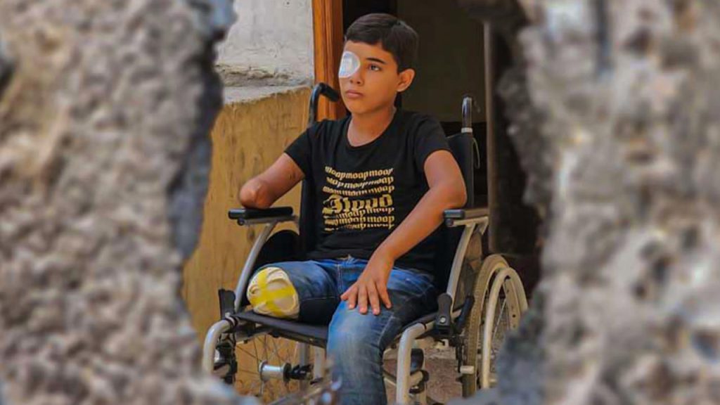 ONU alerta creciente número de niños discapacitados y en desnutrición en la Franja de Gaza 