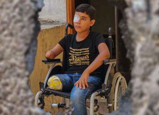 Ataques israelíes en Gaza han dejado a 21.000 niños con discapacidades ONU alerta creciente número de niños discapacitados y en desnutrición en la Franja de Gaza