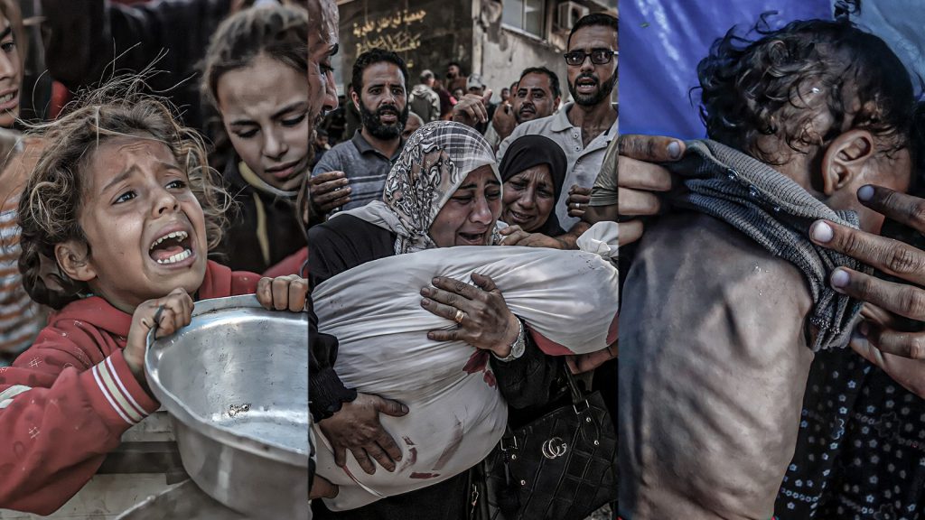 El impacto real del genocidio israelí en Gaza es aún mayor por hambre y enfermedades