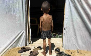 ONU: restricciones de Israel disparan la desnutrición infantil en Gaza Unicef denuncia niveles críticos de desnutrición infantil en Gaza